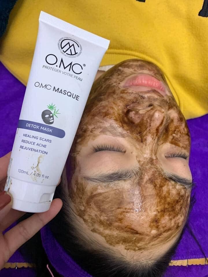 Mặt nạ đen OMC giúp kiềm dầu sáng da